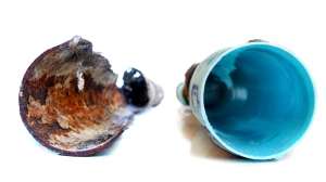 Before And After Nu Drain 5 1000 665